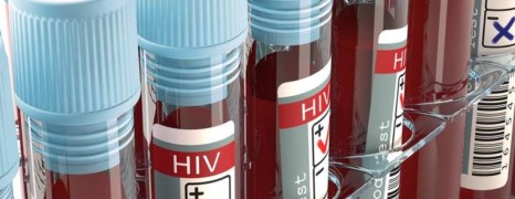 VIH : la Covid pourrait provoquer jusqu’à 150 000 décès supplémentaires