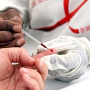 Approbation du premier autotest de VIH au Canada
