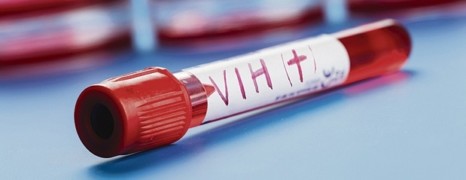 La prise de cabotegravir permettrait de prévenir la contamination par le VIH